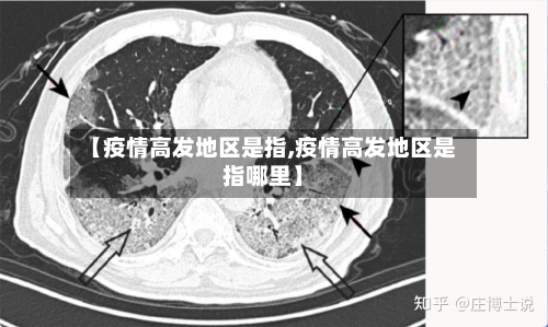【疫情高发地区是指,疫情高发地区是指哪里】