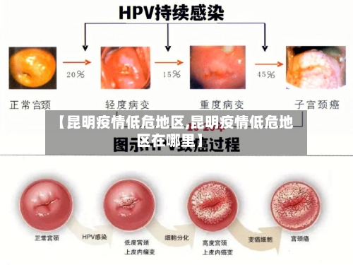 【昆明疫情低危地区,昆明疫情低危地区在哪里】