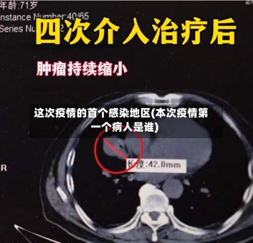 这次疫情的首个感染地区(本次疫情第一个病人是谁)