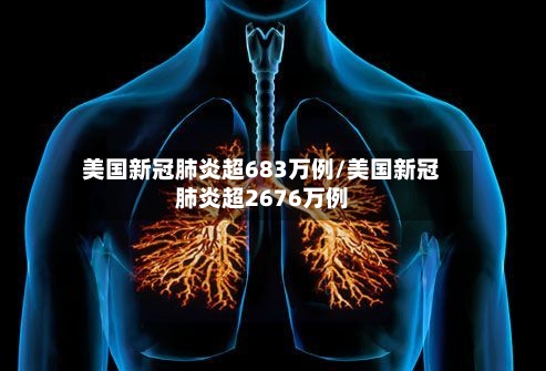 美国新冠肺炎超683万例/美国新冠肺炎超2676万例-第3张图片