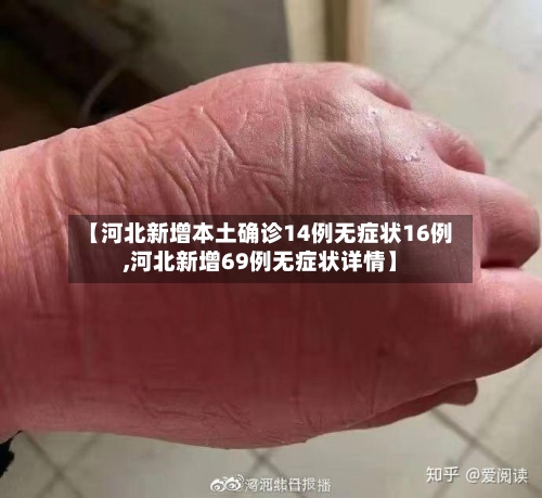 【河北新增本土确诊14例无症状16例,河北新增69例无症状详情】-第3张图片