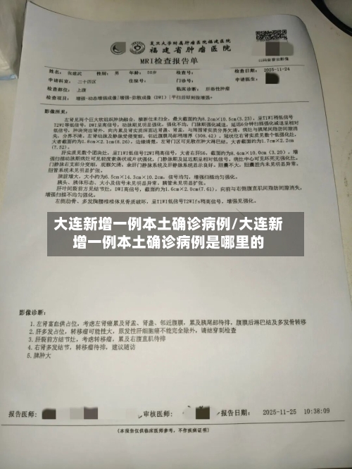 大连新增一例本土确诊病例/大连新增一例本土确诊病例是哪里的-第3张图片