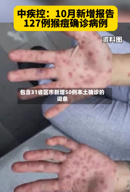 包含31省区市新增50例本土确诊的词条